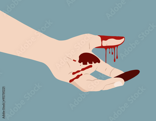 Finger cut, bleeding injured with knife, Flesh blood wound in hand.