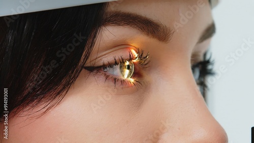 Beautiful female eye with yellow laser ray. Vision correction surgery on female eye. In a modern ophthalmology operating room, a patient is prepared for surgery. The concept of modern technologies