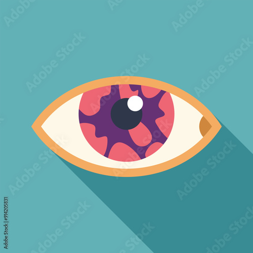 Illustration of a bloodshot eye, showing symptoms of disease such as glaucoma or conjunctivitis