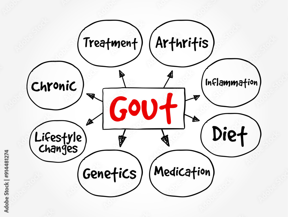 Gout - form of inflammatory arthritis that is very painful, mind map text concept background Gout - form of inflammatory arthritis that is very painful, mind map text concept background