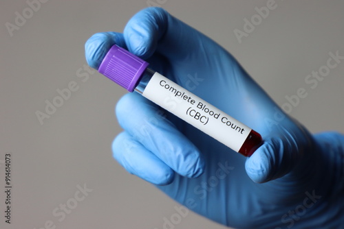 Blood test sample for complete blood count test in a healthcare professional wearing gloves and holding the tube 
