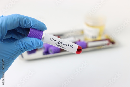 Different blood samples and urine samples in line to have a health check up 
