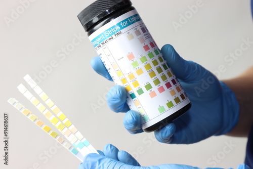 Professional wearing gloves holding a bottle of reagent strips for urinalysis  photo