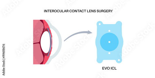 EVO ICL poster