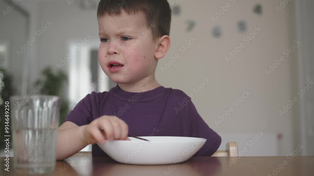Child boy has chickenpox eating soup face dotted with red spots reflecting discomfort and illness. Chickenpox itching discomfort knowing he soon overcome chickenpox illness Boy with sick Child boy has chickenpox eating soup face dotted with red spots reflecting discomfort and illness. Chickenpox itching discomfort knowing he soon overcome chickenpox illness Boy with sick