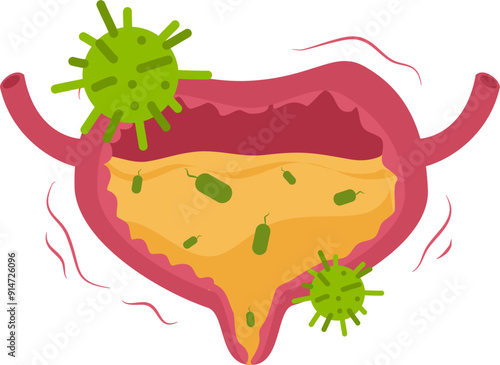 Urinary bladder disease.Urinary tract infection Illustration.