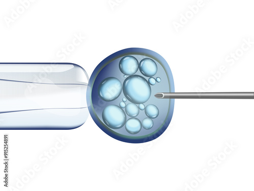 in vitro fertilization (IVF) Illustration