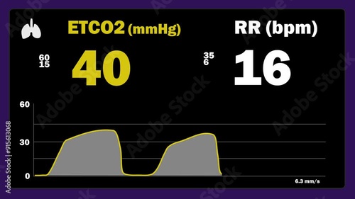 Capnography Monitor Equipment Screen - ETCO2 values , waveform and respiratory rate photo