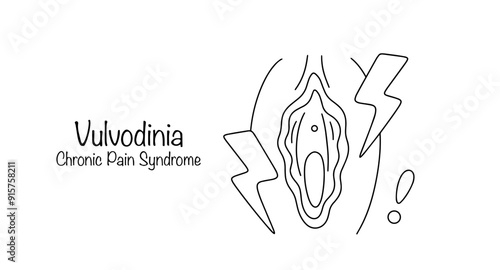 Vulvodynia