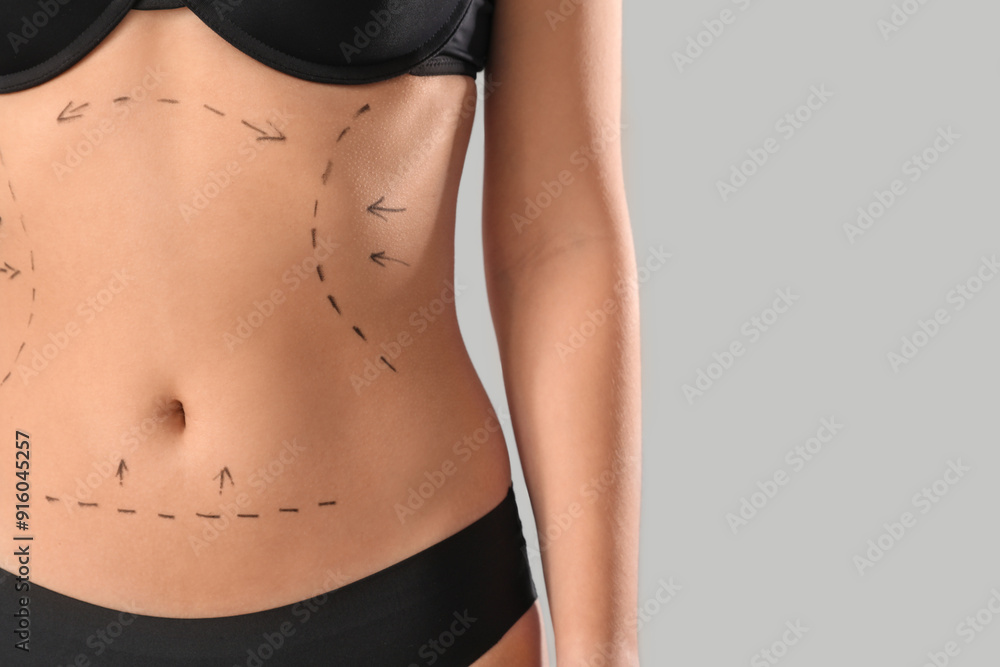 Young woman in underwear with marks on her belly against grey background, closeup. Plastic surgery concept Young woman in underwear with marks on her belly against grey background, closeup. Plastic surgery concept