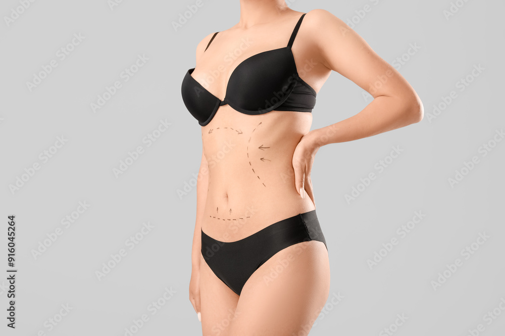Young woman in underwear with marks on her belly against grey background. Plastic surgery concept Young woman in underwear with marks on her belly against grey background. Plastic surgery concept