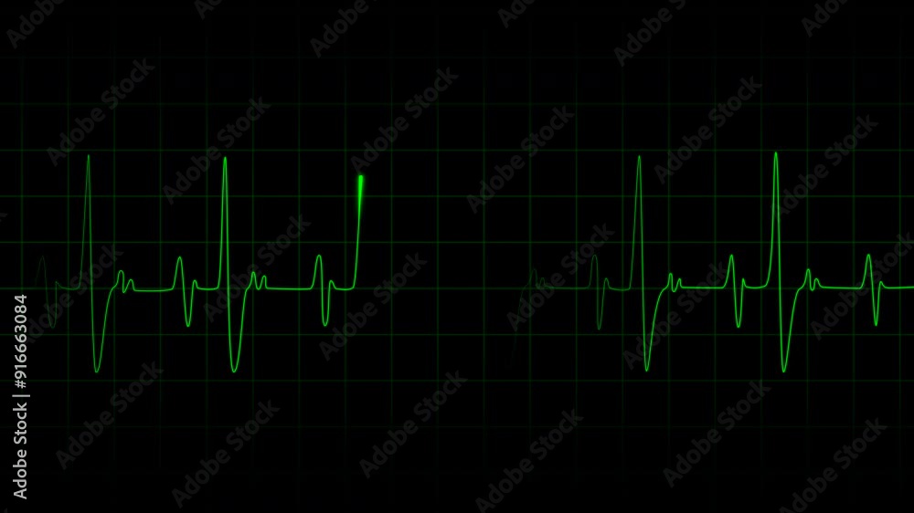 Heart beat pulse. Glowing neon green heart cardiogram line on dark background. Heartbeat rate looping animation Heart beat pulse. Glowing neon green heart cardiogram line on dark background. Heartbeat rate looping animation