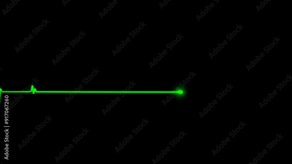 Electrocardiogram show heart beat line. cardiogram, Heart pulse. Motion graphic seamless loop animation Electrocardiogram show heart beat line. cardiogram, Heart pulse. Motion graphic seamless loop animation