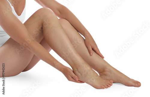 Woman suffering from varicose veins on white background, closeup