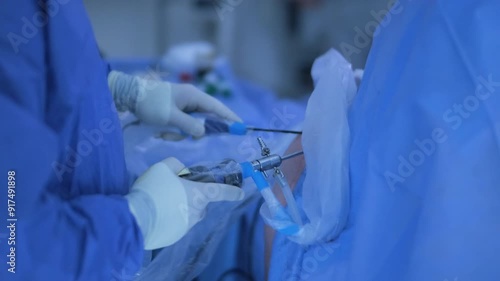 Arthroscopy of the shoulder joint
