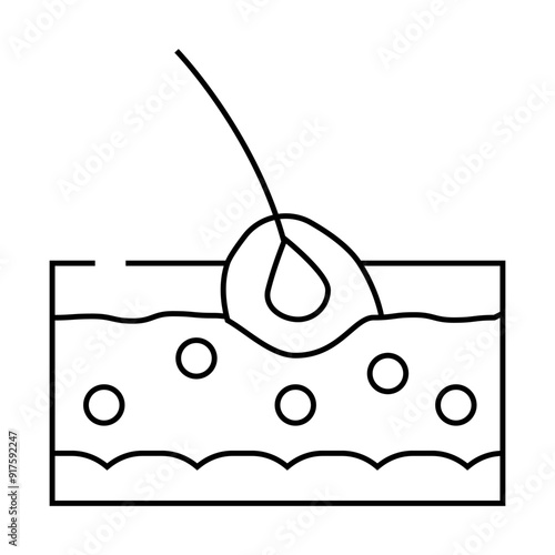 folliculitis skin disease problem line icon vector. folliculitis skin disease problem sign. isolated contour symbol black illustration