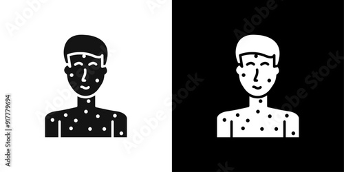 Boy chicken pox icon Symbol mark in filled style
