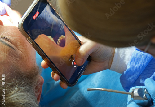 Dentist performing dental surgery and person taking photo of dental treatment with phone
