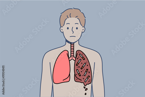 Man smoker with destroyed lungs is forced to suffer due to addiction of tobacco and nicotine. Guy who smokes needs surgery due to smoking for long time and lack of willpower for fight bad habit.