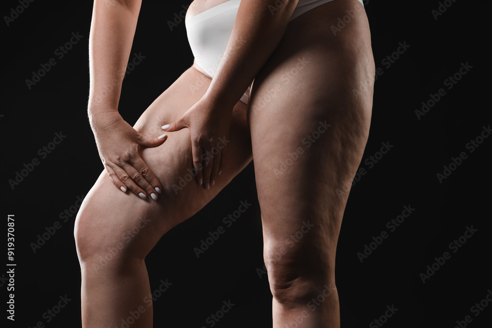 Naklejka premium Woman with cellulite on black background, closeup