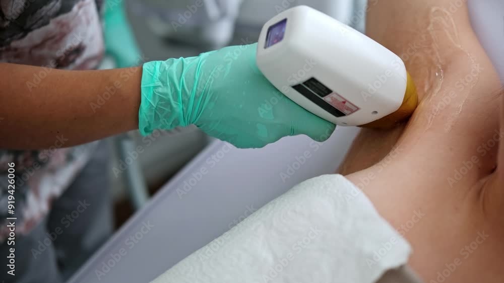 Laser Hair Removal Procedure For Smoother Female Armpit Skin At A Beauty Spa Clinic Laser Hair Removal Procedure For Smoother Female Armpit Skin At A Beauty Spa Clinic