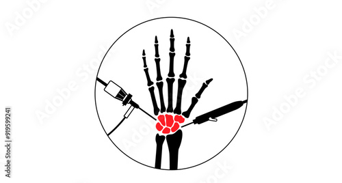Wrist arthroscopy surgery