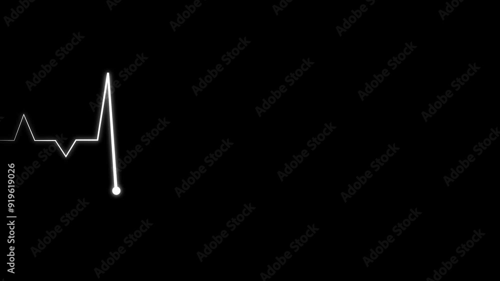 Abstract heart rate monitor, ECG graph, patient pulse, cardiogram, white color right direction animation on black background. Abstract heart rate monitor, ECG graph, patient pulse, cardiogram, white color right direction animation on black background.