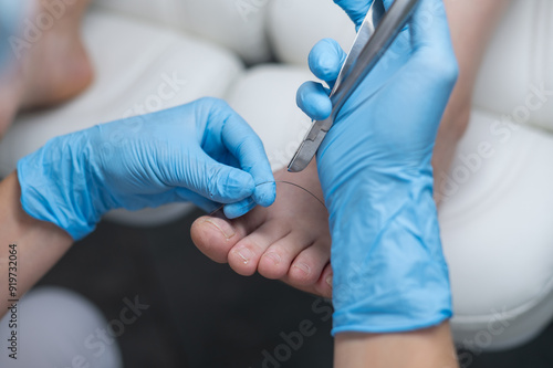 Hands in blue medical gloves folded in the shape of a heart on a white background. Foot care. Podologist