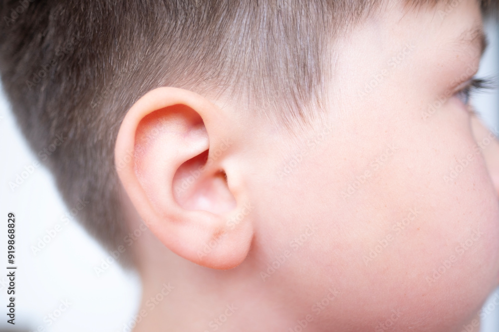 Close-up detail young caucasian male ear, auditory organ, acoustics Auditory System, Ear Discomfort, Hearing Test Close-up detail young caucasian male ear, auditory organ, acoustics Auditory System, Ear Discomfort, Hearing Test
