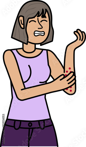 woman with allergy scratching her hand