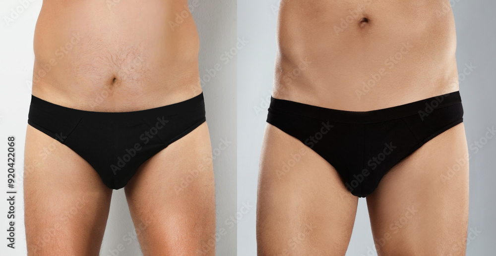 Man before and after weight loss on light grey background, closeup. Collage of photos Man before and after weight loss on light grey background, closeup. Collage of photos