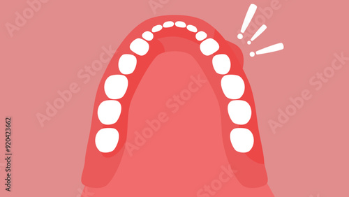 Oral Cancer, flat color illustration