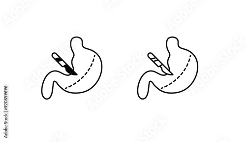 Bariatric Surgery icon design with white background stock illustration