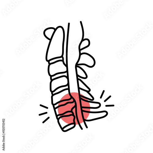 Facet syndrome color line icon. Diseases of the spine