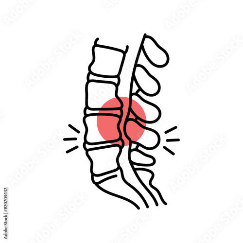 Lumbar stenosis color line icon. Diseases of the spine