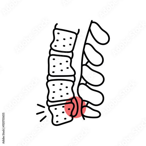 Spinal abscess color line icon. Diseases of the spine