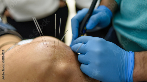 Physiotherapy clinic Intratissue Percutaneous Electrolysis