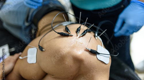 Physiotherapy clinic Intratissue Percutaneous Electrolysis photo