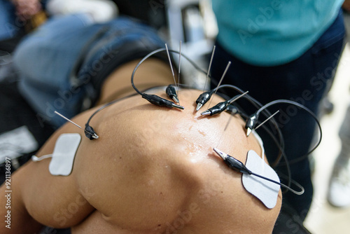 Physiotherapy clinic Intratissue Percutaneous Electrolysis