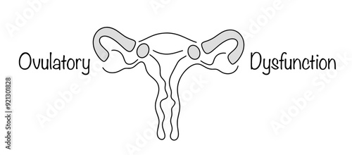 Ovulatory Dysfunction