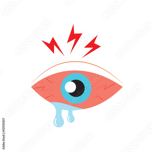 Eye sore color line icon, disease and allergy, eye redness vector icon, vector graphics, editable stroke filled outline sign
