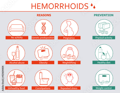 Infographic of hemorrhoid disease reasons and prevention. Medical info poster. Flat vector illustration