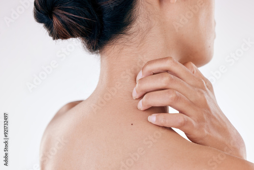 Quadro em tela Back, woman and scratch neck in studio with skin irritation, skincare emergency and discomfort of allergy problem