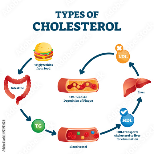 Types of cholesterol educational cycle scheme from fatty food to artery, transparent background. Labeled symbolic diagram with explanation how intestine produce TG and HDL transportation to liver.