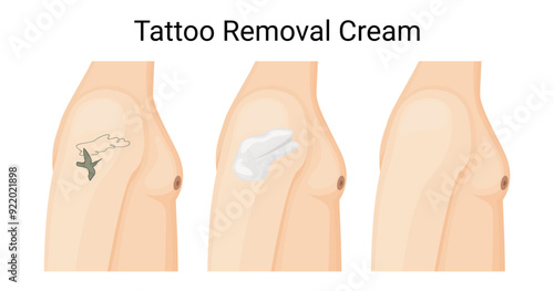Effective Tattoo Removal Cream for Clear Skin Vector Illustration