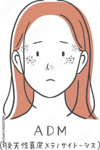 シミ（ADM）に悩む女性のイラスト素材