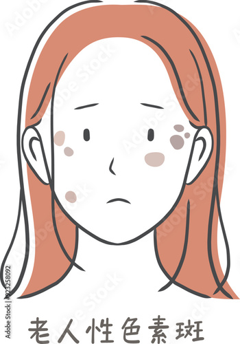 シミ（老人性色素斑）に悩む女性のイラスト素材
