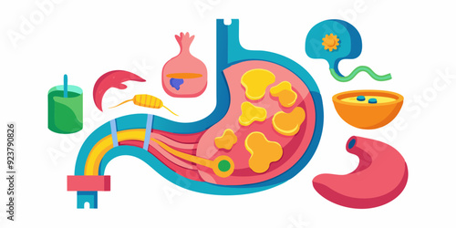 3D stomach vector set, esophagus icon kit, anatomy medical illustration, human internal organ. Sick abdomen, acid digestive ache, gastric digestive system on white. 3D stomach pain biology clipart