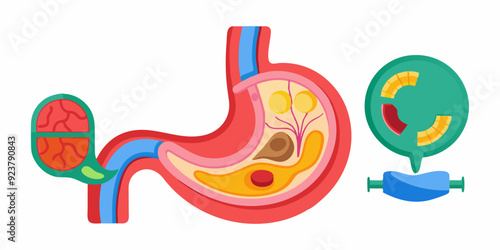 3D stomach vector set, esophagus icon kit, anatomy medical illustration, human internal organ. Sick abdomen, acid digestive ache, gastric digestive system on white. 3D stomach pain biology clipart