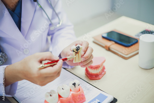 Dentures, dentures in the jaw, root canal treatment, gum disease, tooth models for dentists who are studying dentistry.